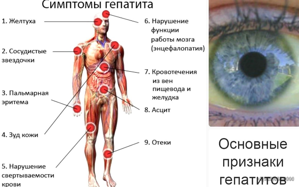 Купить справку медицинскую справку от гепатита
